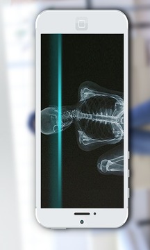 手机X光扫描仪